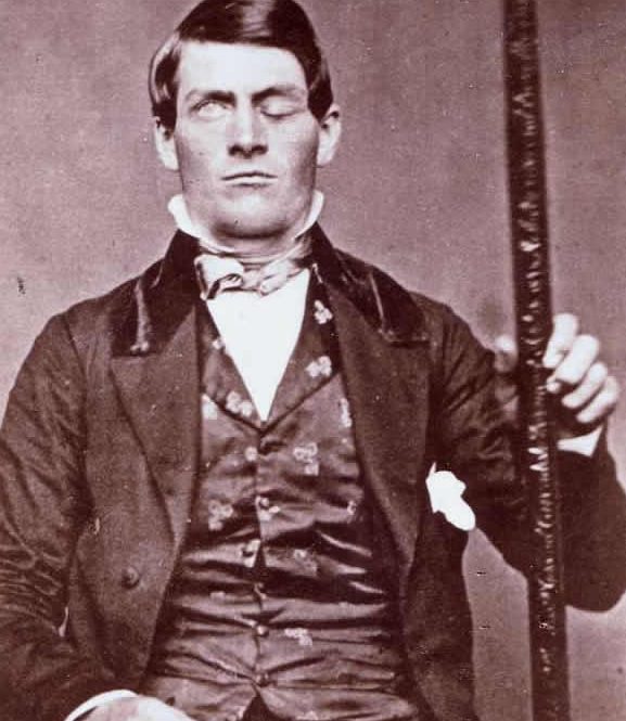Phineas Gage